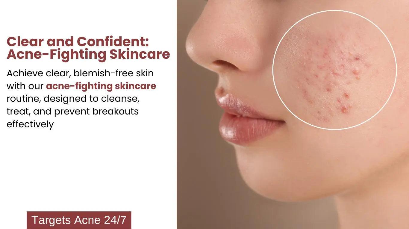 Ammuri Skincare Pigmentation Treatment Skincare Package