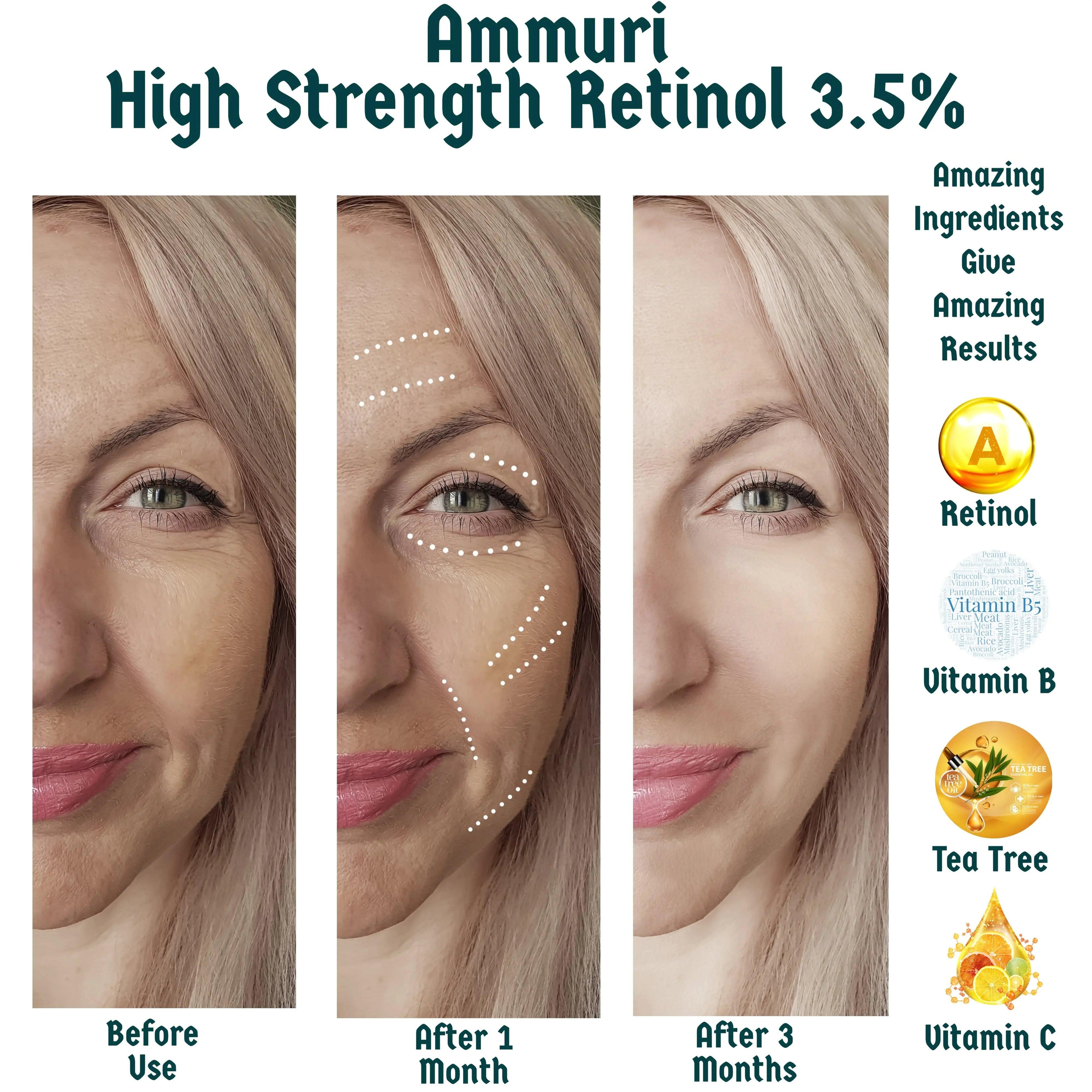 Ammuri 3.5% Retinol High Strength Face Serum – Anti-Ageing Formula